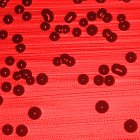 <i>Haemophilus Influenzae</i>